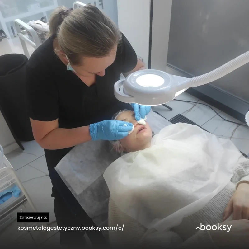 Oczyszczanie,peelingi, mikroiglowa terapia, masaż limfatyczny twarzy.Częstochowska 19C Gdańsk - zdjęcie 12